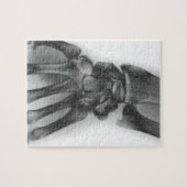 通常の手首、X線 ジグソーパズル (横)