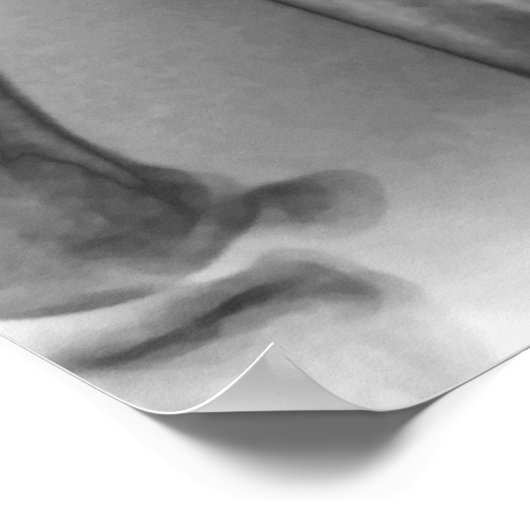 通常の手首、X線 ポスター (角)