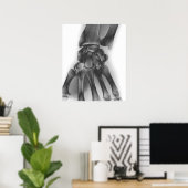 通常の手首、X線 ポスター (ホームオフィス)