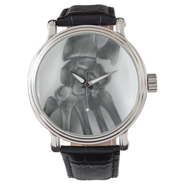 通常の手首、X線 腕時計 (正面)