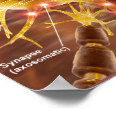 運動ニューロン ポスター (角)