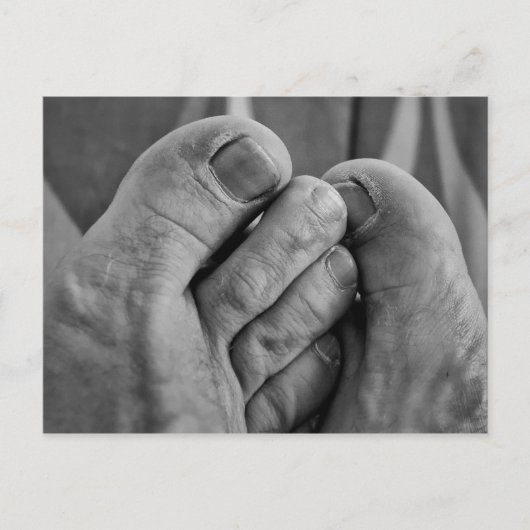 醜い足 ポストカード (正面)