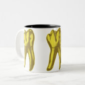 金歯 ツートーンマグカップ (正面左)