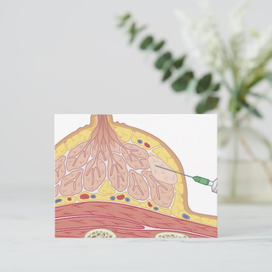 針吸引素晴らし法 ポストカード (スタンド正面)