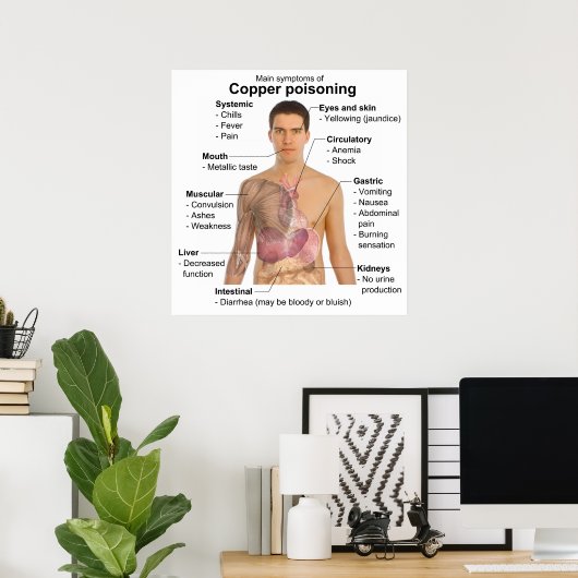 銅中毒の主な症状表 ポスター (ホームオフィス)