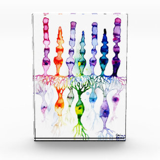 錐体細胞棒細胞と網膜の双極性ニューロン フォトブロック