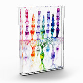 錐体細胞棒細胞と網膜の双極性ニューロン フォトブロック (左)