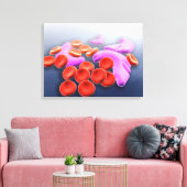 鎌状赤血球貧血の概念像 キャンバスプリント (インサイチュ (リビング))