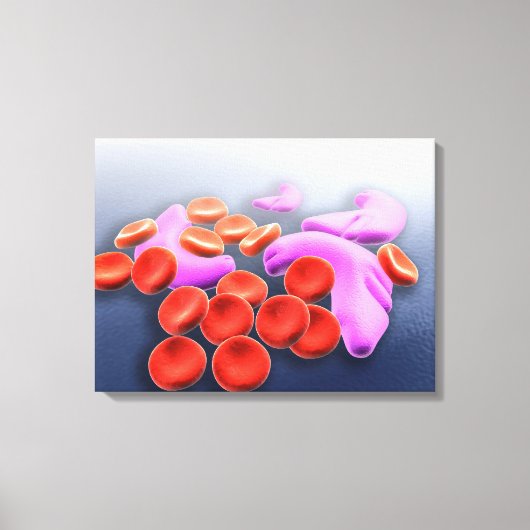 鎌状赤血球貧血の概念像 キャンバスプリント (正面)