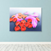 鎌状赤血球貧血の概念像 キャンバスプリント (インサイチュ (ウッドフロア))