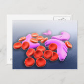 鎌状赤血球貧血の概念像 ポストカード (正面/裏面)