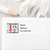 雛が三つの肺がん ラベル (インサイチュ)