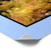 静脈瘤 ポスター (角)