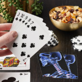 頭と首の骨7 トランプ (インサイチュ)