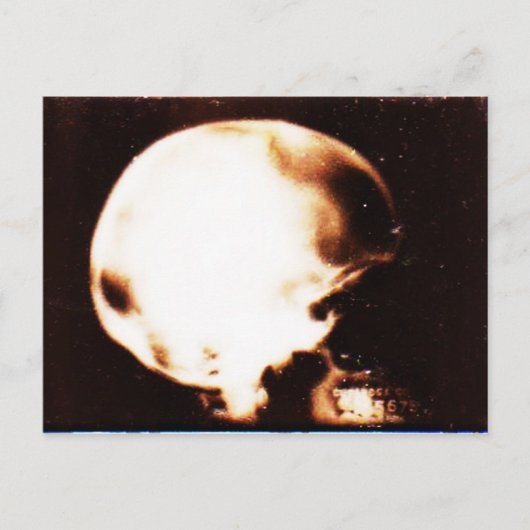 頭の空の ポストカード (正面)