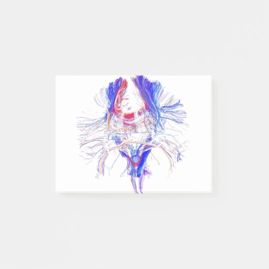 頭脳およびTracktography ポストイット (正面)