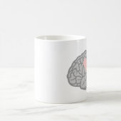 頭脳痛み コーヒーマグカップ (中央)