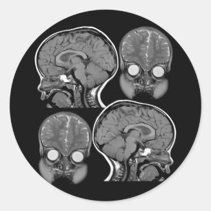頭脳! (MRI) ラウンドシール