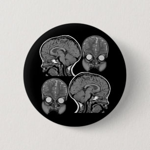 頭脳! (MRI) 缶バッジ