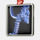 頭部および首の骨 メタルオーナメント (左)