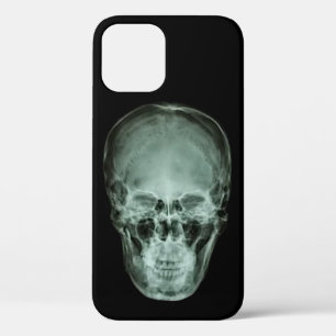 頭部スカルX線 iPhone 12ケース