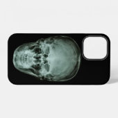 頭部スカルX線 iPhoneケース (裏面横)