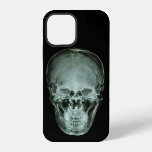 頭部スカルX線 iPhoneケース (裏面)