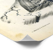 頭頸部解剖学プリント ポスター (角)