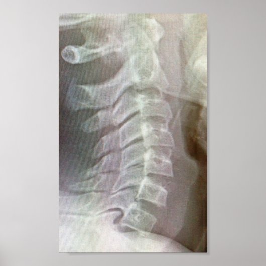 頸椎タイ ポスター (正面)