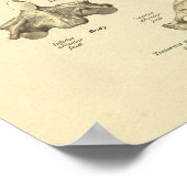 頸椎解剖学的地図軸プリント ポスター (角)