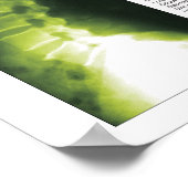 頸腰脊髄変性ポスター ポスター (角)