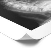 頸部スペインの脊髄脱臼 ポスター (角)