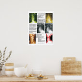 頸部脊髄変性ポスター ポスター (キッチン)