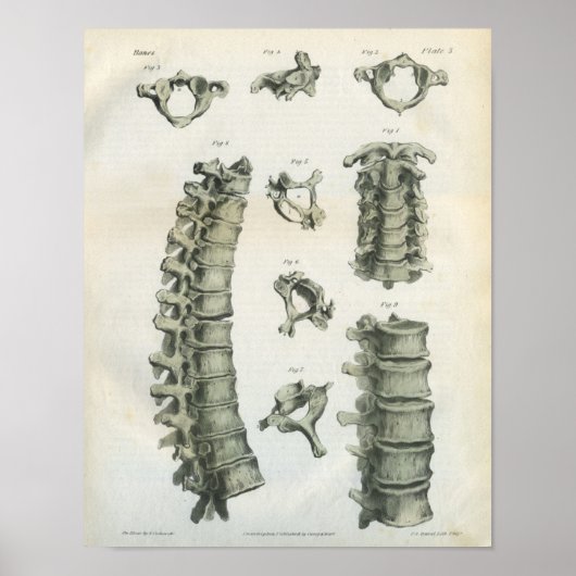 頸部・胸部カイロプラクティック ポスター (正面)