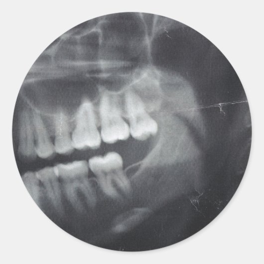 顎のシール ラウンドシール (正面)