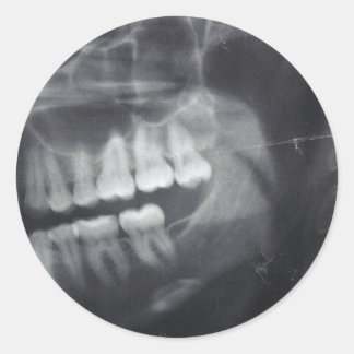 顎のシール ラウンドシール