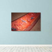 顕微描写視的血液感染 キャンバスプリント (インサイチュ (ウッドフロア))