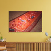 顕微描写視的血液感染 キャンバスプリント (インサイチュ (リビング))