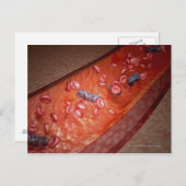 顕微描写視的血液感染 ポストカード (正面/裏面)