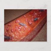 顕微描写視的血液感染 ポストカード (正面)