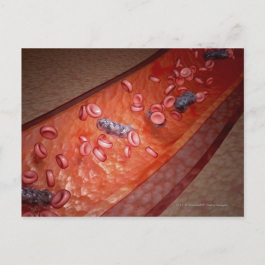 顕微描写視的血液感染 ポストカード (正面)