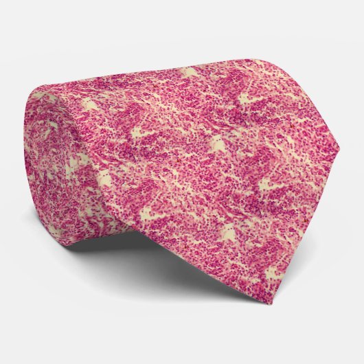 顕微鏡の下のリンパ節の細胞 ネクタイ (ロール)