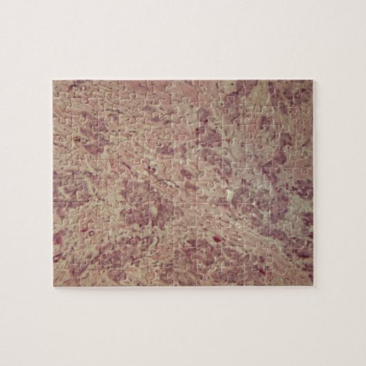 顕微鏡の下の乳癌 ジグソーパズル (横)