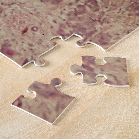 顕微鏡の下の乳癌 ジグソーパズル (側面)