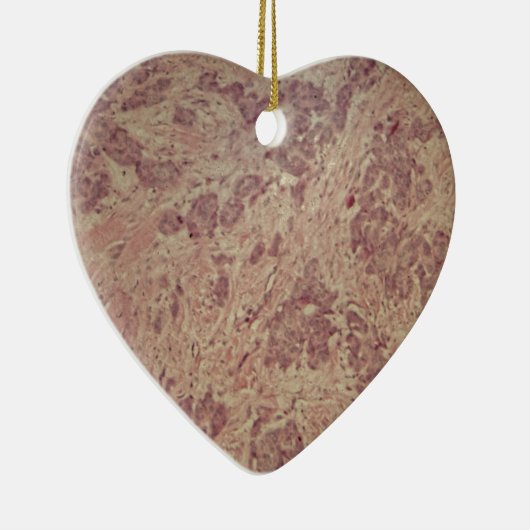 顕微鏡の下の乳癌 セラミックオーナメント (右)