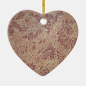 顕微鏡の下の乳癌 セラミックオーナメント (正面)