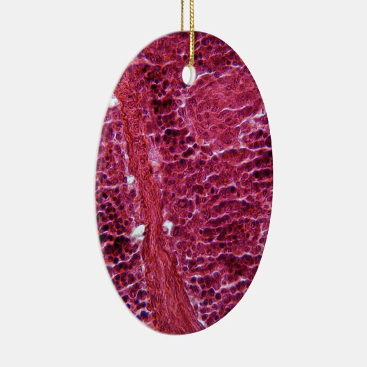 顕微鏡の下の膵臓の細胞 セラミックオーナメント (右)