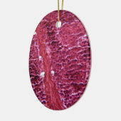 顕微鏡の下の膵臓の細胞 セラミックオーナメント (左)