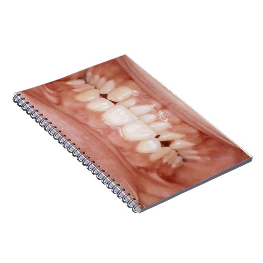 風変わりで珍しい血だらけの歯のゴムの写真 ノートブック (右側)