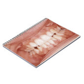 風変わりで珍しい血だらけの歯のゴムの写真 ノートブック (左側)